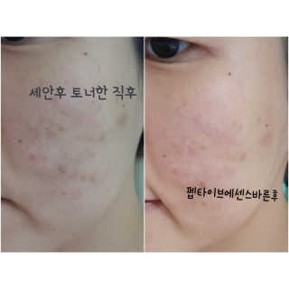 엘리자베카 펩타이드 쓰리디 픽스 슈팅 버블 페이셜 에센스 — 4.67점을 준 리뷰어가 2018년 7월 올린 사용 사진