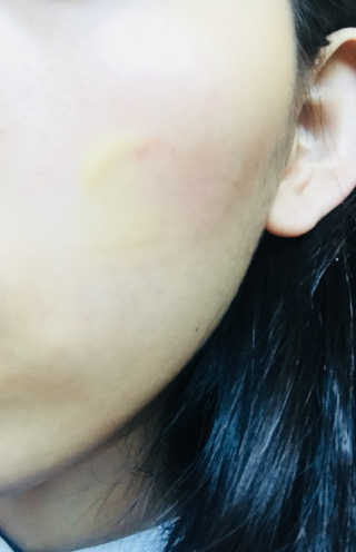 보타니티 [홍]조[진]정[결]케어 플라본 세럼 — 5점을 준 리뷰어가 2018년 5월 올린 사용 사진
