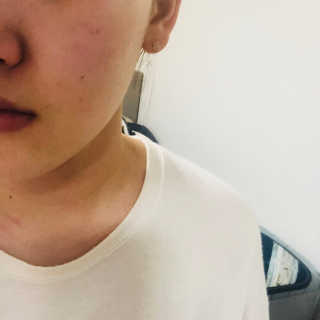 보타니티 [홍]조[진]정[결]케어 플라본 세럼 — 4점을 준 리뷰어가 2018년 5월 올린 사용 사진