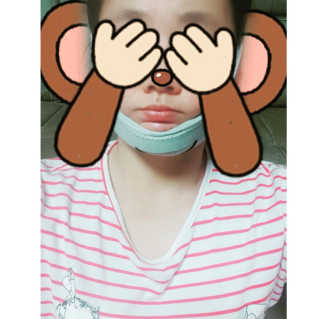 메디미 브이미 업 2스텝 브이라인벨트 — 5점을 준 리뷰어가 2017년 9월 올린 사용 사진