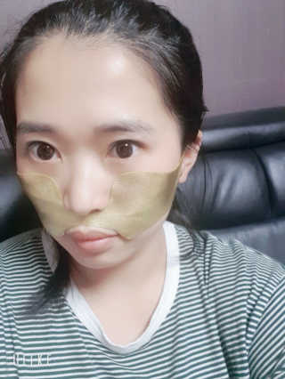 [스케덤] 상악밴드 — 5점을 준 리뷰어가 2019년 7월 올린 사용 사진