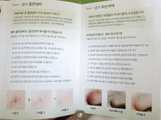 플러스셀라 시카골드 클렌징바 화산재팩 세트 — 5점을 준 리뷰어가 2020년 3월 올린 사용 사진