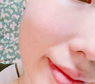 유산균하우스 [프로바이오닉]스킨프로바이오틱스 마스크 10매입 — 4.5점을 준 리뷰어가 2019년 4월 올린 사용 사진