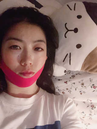 스케덤 펩타이드 리프팅밴드 — 4점을 준 리뷰어가 2019년 6월 올린 사용 사진