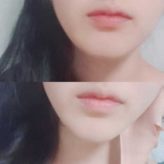 아이디플라코스메틱 아이디 페이스핏 마이너스 밴드 — 4점을 준 리뷰어가 2020년 3월 올린 사용 사진