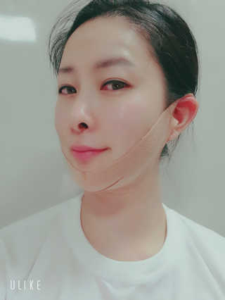 아이디플라코스메틱 아이디 페이스핏 마이너스 밴드 — 5점을 준 리뷰어가 2019년 11월 올린 사용 사진