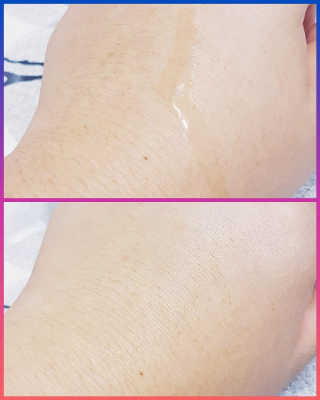 키노닉스 펀더멘탈 하이드레이팅 앰플 부스터 — 3점을 준 리뷰어가 2019년 3월 올린 사용 사진