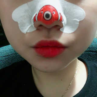 나이팅게일 TAKO PACK NOSE [문어코팩] — 3.5점을 준 리뷰어가 2016년 12월 올린 사용 사진