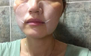 리체 뷰랑셀 케어 스팟 포인트팩 — 4.17점을 준 리뷰어가 2017년 7월 올린 사용 사진