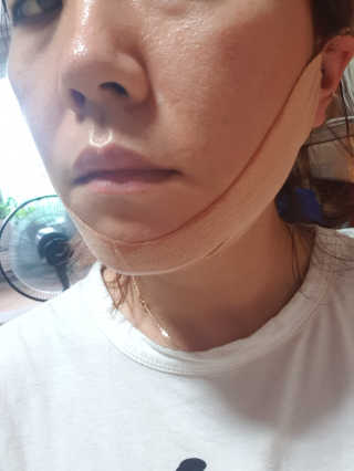 아이디플라코스메틱 아이디 페이스핏 마이너스 밴드 — 4점을 준 리뷰어가 2019년 9월 올린 사용 사진
