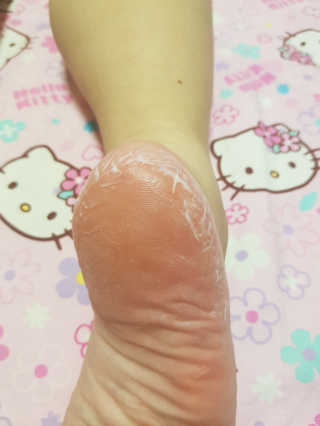 (주)에네스티 에네스티 수안수 실크스킨 풋크림 1+1 — 5점을 준 리뷰어가 2019년 9월 올린 사용 사진