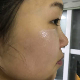 셀퓨전씨 트리악 포어 딜리트 버블 팩 — 3점을 준 리뷰어가 2018년 4월 올린 사용 사진