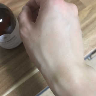 약해진 피부엔 닥터라플레 올인원로션 — 5점을 준 리뷰어가 2019년 8월 올린 사용 사진
