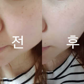 브이티 코스메틱 VT 리얼 콜라겐 팩트 — 4.17점을 준 리뷰어가 2017년 4월 올린 사용 사진