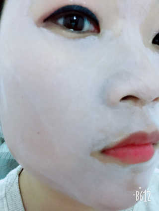 셀퓨전씨 트리악 포어 딜리트 버블 팩 — 4점을 준 리뷰어가 2018년 4월 올린 사용 사진