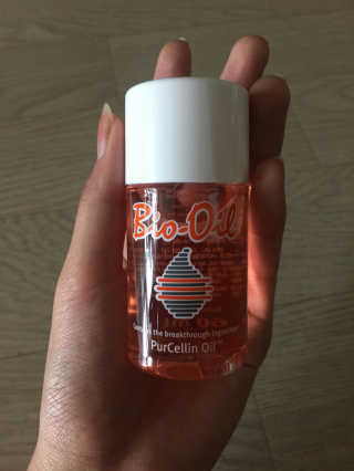 Bio-oil(바이오오일) 바이오오일 — 4점을 준 리뷰어가 2016년 10월 올린 사용 사진