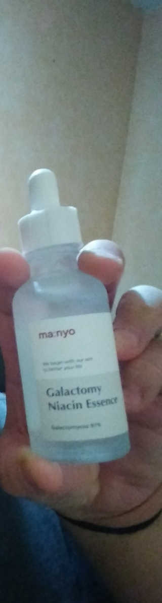 [마녀 공장] 발가락 토미 니아신 에센스 50ml — 1점을 준 리뷰어가 2019년 4월 올린 사용 사진