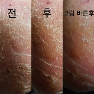 유어비 부탁해 발 부탁해 발 글라스 풋 파일 — 4.5점을 준 리뷰어가 2019년 4월 올린 사용 사진