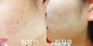 셀레뷰 블랙 세럼 팩트 — 3.5점을 준 리뷰어가 2017년 9월 올린 사용 사진