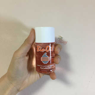 Bio-oil(바이오오일) 바이오오일(Bio-oil) — 3.5점을 준 리뷰어가 2017년 2월 올린 사용 사진