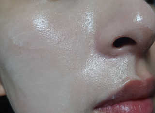 닥터엘시아 파워 브라이트닝 글루타치온 크림 — 3점을 준 리뷰어가 2018년 3월 올린 사용 사진