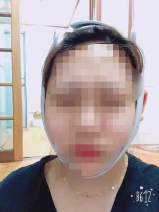 메디미 브이미 업 2스텝 브이라인벨트 — 4.67점을 준 리뷰어가 2017년 8월 올린 사용 사진