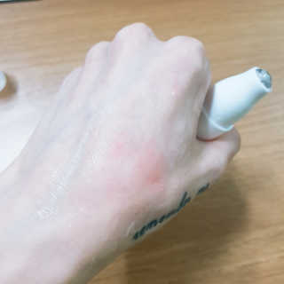 쏘내추럴 화이트닝 스팟 코렉터 — 4점을 준 리뷰어가 2019년 8월 올린 사용 사진