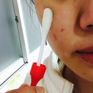 나이팅게일 토닝이레이저 — 3.5점을 준 리뷰어가 2016년 12월 올린 사용 사진