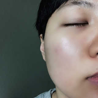 메디필 센시카 알라 크림, 센시카 카밍 앰플 — 5점을 준 리뷰어가 2020년 1월 올린 사용 사진