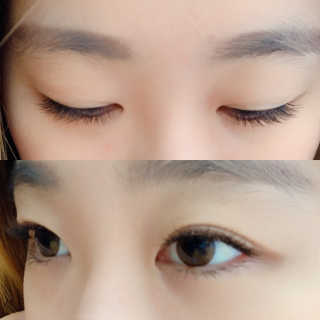 Viewty Skin and Lash [ViewtySkin＆Lash] 종아리 림프순환 부종관리 — 4.5점을 준 리뷰어가 2019년 2월 올린 사용 사진