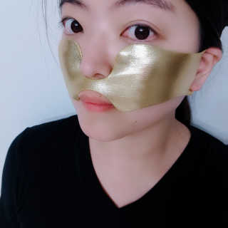 [스케덤] 상악밴드 — 4점을 준 리뷰어가 2019년 5월 올린 사용 사진