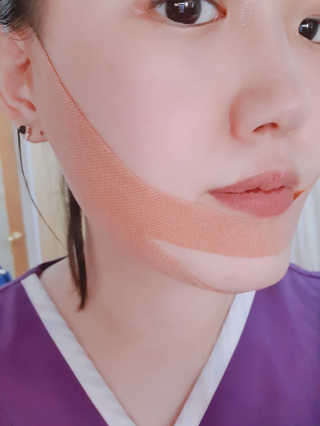 아이디플라코스메틱 아이디 페이스핏 마이너스 밴드 — 4점을 준 리뷰어가 2020년 3월 올린 사용 사진