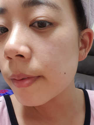 쏘내추럴 샤이닝 페이스 필링 패드 — 4점을 준 리뷰어가 2019년 8월 올린 사용 사진