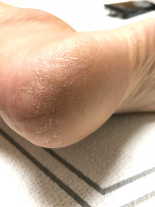 ㅇ님이 올린 리뷰 사진 1