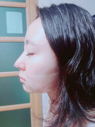 [더마허브] 주사팩 5종, 물광,백옥,태반,신데렐라 등 — 4.33점을 준 리뷰어가 2018년 3월 올린 사용 사진