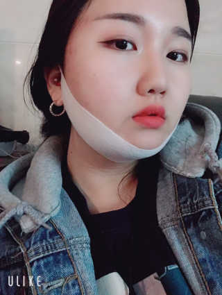 스케덤 클루덤 리프팅 패치 — 4점을 준 리뷰어가 2019년 4월 올린 사용 사진