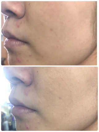 抹茶子님이 올린 리뷰 사진 3