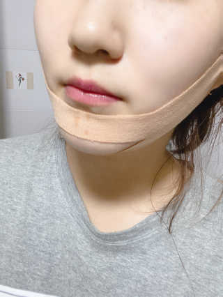 아이디플라코스메틱 아이디 페이스핏 마이너스 밴드 — 5점을 준 리뷰어가 2019년 12월 올린 사용 사진