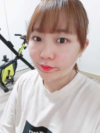 아이디플라코스메틱 아이디 페이스핏 마이너스 밴드 — 5점을 준 리뷰어가 2019년 9월 올린 사용 사진