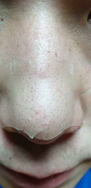 메디힐 슬리핑 멜팅 코팩 — 5점을 준 리뷰어가 2020년 1월 올린 사용 사진