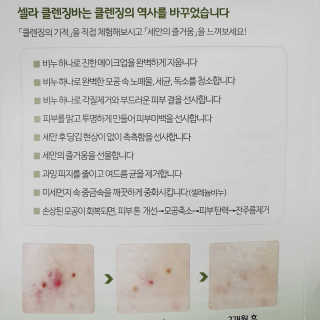 플러스셀라 시카골드 클렌징바 화산재팩 세트 — 5점을 준 리뷰어가 2020년 1월 올린 사용 사진