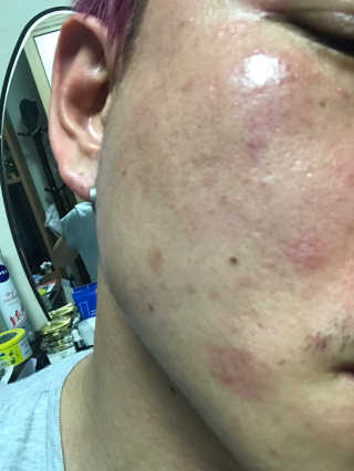 [후르디아] 72시간 블루베리 속살 수분크림 — 5점을 준 리뷰어가 2019년 6월 올린 사용 사진