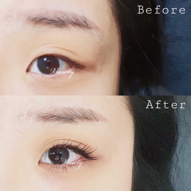 [ViewtySkin＆Lash] 종아리 림프순환 부종관리 리뷰 사진