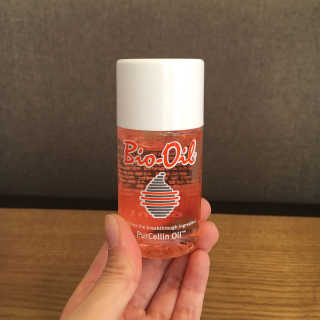 Bio-oil(바이오오일) 바이오오일(Bio-oil) — 5점을 준 리뷰어가 2017년 1월 올린 사용 사진