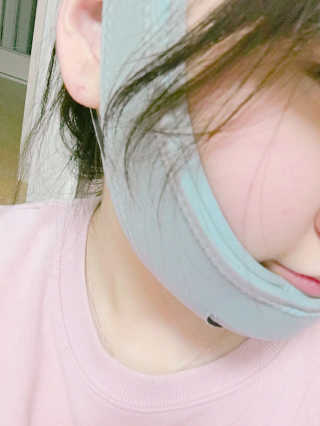 메디미 브이미 업 2스텝 브이라인벨트 — 5점을 준 리뷰어가 2017년 5월 올린 사용 사진