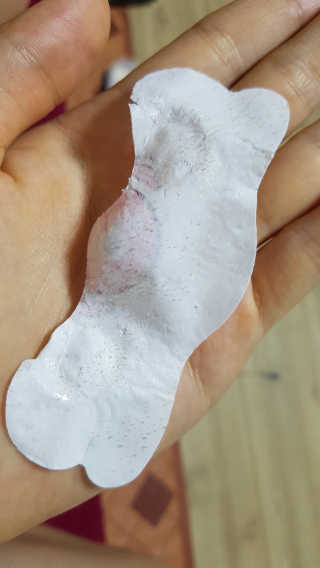 나이팅게일 TAKO PACK NOSE [문어코팩] — 5점을 준 리뷰어가 2017년 6월 올린 사용 사진