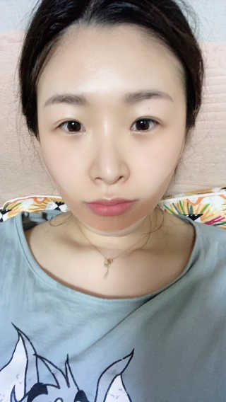 아이디플라코스메틱 아이디 페이스핏 마이너스 밴드 — 4점을 준 리뷰어가 2020년 3월 올린 사용 사진