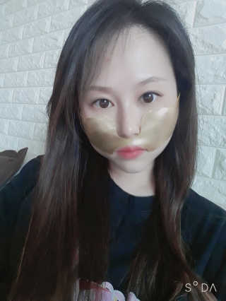 [스케덤] 상악밴드 — 3점을 준 리뷰어가 2019년 8월 올린 사용 사진
