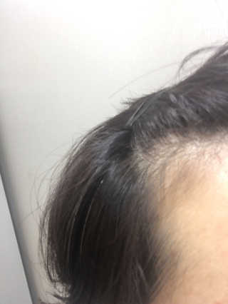 다슈코리아 다슈 안티 헤어로스 헤어쿠션 16g — 4점을 준 리뷰어가 2017년 6월 올린 사용 사진