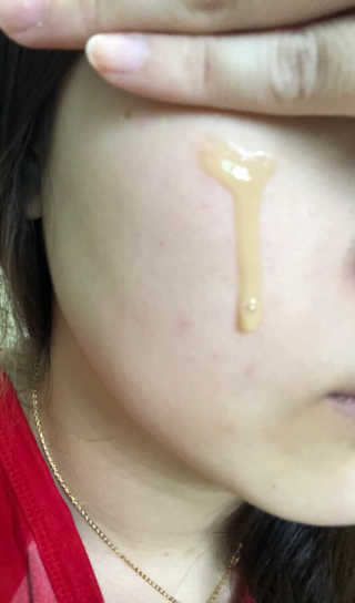 보타니티 [홍]조[진]정[결]케어 플라본 세럼 — 4.83점을 준 리뷰어가 2018년 5월 올린 사용 사진